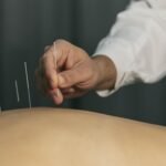 Governo federal regulamenta atuação profissional da acupuntura no Brasil