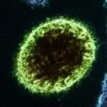 “Brasil não tem caso de Nipah confirmado” diz Ministério da Saúde sobre fake news