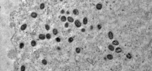 Brasil já registrou 81 casos de mpox neste ano