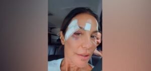 Após sofrer desmaio, Ivete Sangalo recebe alta e revela diagnóstico médico