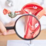 HPV causou 7,5 mil mortes por câncer ao ano no Brasil entre 2011 e 2019
