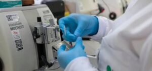 SUS vai oferecer novo tratamento para pacientes com leucemia mieloide aguda